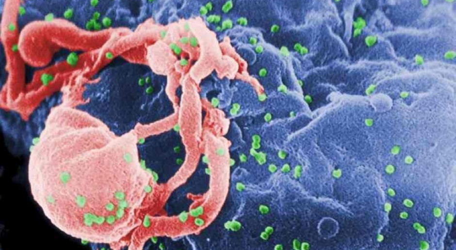Esperal może pomóc pokonać wirusa HIV?