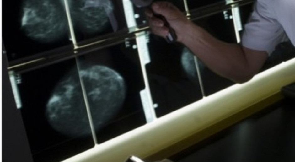 Elbląg: szpital miejski zaprasza na mammografię