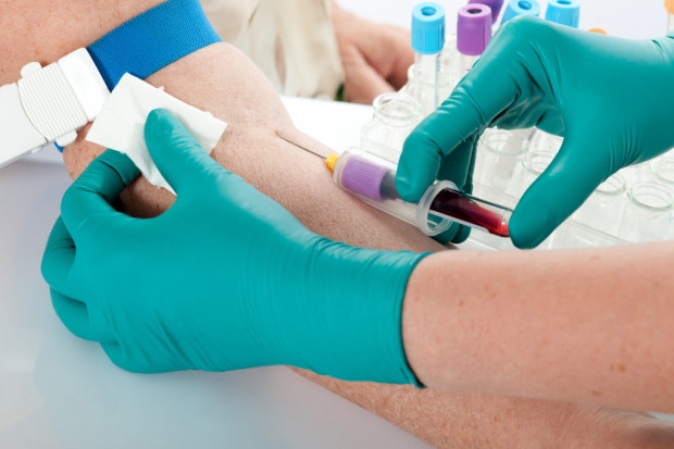 Badaniami diagnostycznymi w kierunku Hepatitis A (HAV) objęto łącznie 184 pracowników firmy wytwarzającej artykuły spożywcze. Fot. archiwum Wielkopolska: rośnie liczba zakażeń WZW A