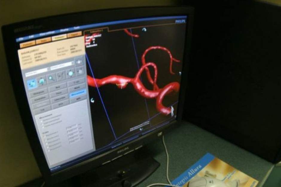 Fot. archiwum RZ Katowice: neurolodzy z GCK leczą udary nowatorsko - trombektomią