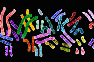 Naukowcy z Cambrigde stworzyli opartą na syntetycznym DNA bakterię Escherichia coli