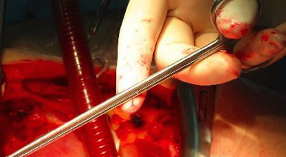 Wzrosła liczba przeszczepów narządów w Polsce
