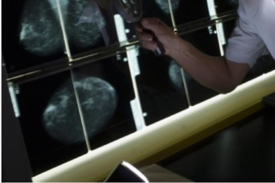 Wrocław: przy DCO powstanie Breast Cancer Unit