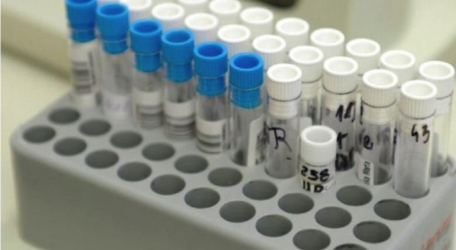 Przeprowadzana jest weryfikacja laboratoryjna każdego przypadku Fot. Archiwum (zdjęcie ilustracyjne) Trzy nowe przypadki odry w województwie śląskim
