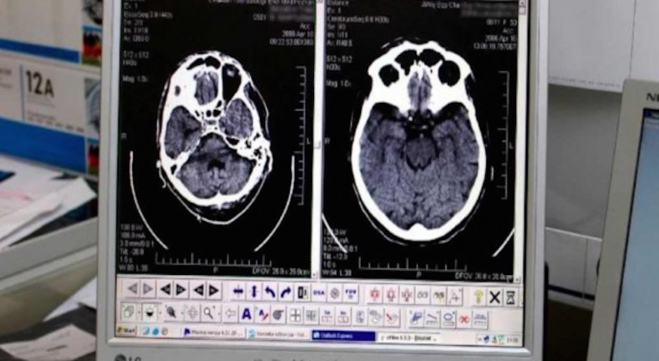 Za niezwykłe doznania występujące u pacjentów z zespołem Tourette'a mogą odpowiadać zmiany w strukturze mózgu Fot. Archiwum Badania: zidentyfikowano zmiany w mózgach dzieci z zespołem Tourette’a