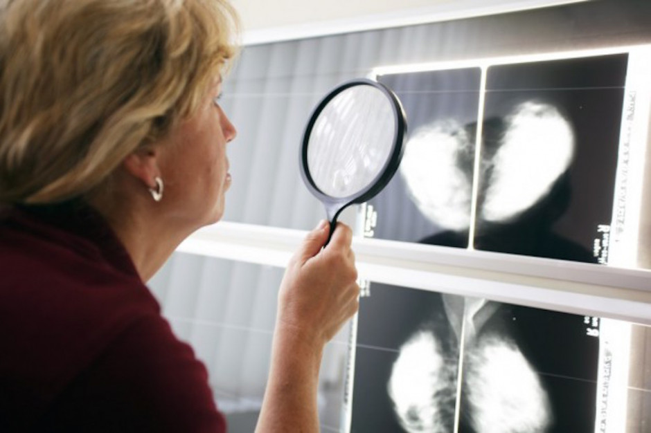 Fot. Shutterstock Eksperci: rośnie liczba zgonów z powodu nowotworów płuca i prostaty