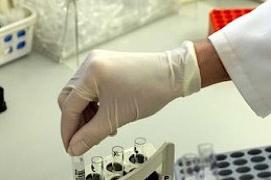 FOT. Arch. RZ; zdjęcie ilustracyjne NIK: w Polsce wykonuje się za mało badań laboratoryjnych w ramach POZ