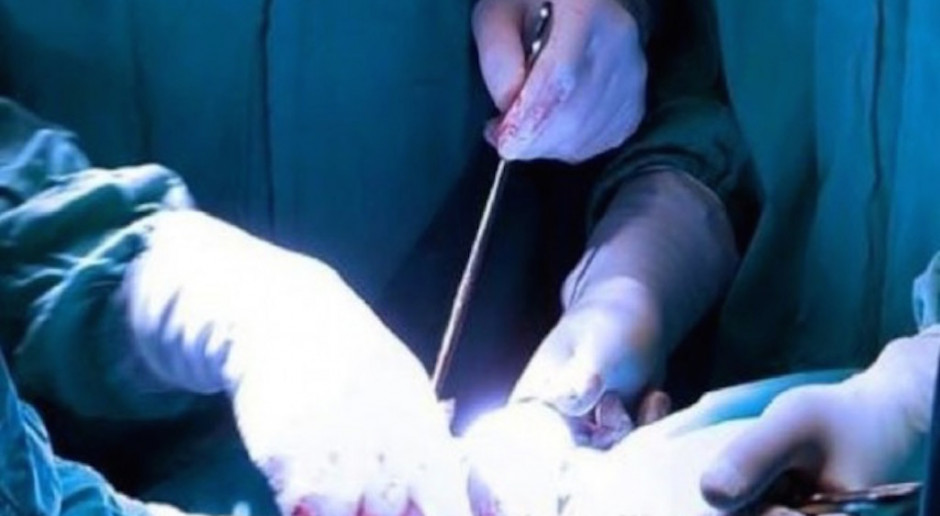 Śląscy lekarze przezskórnie zamknęli źle połączone naczynia w sercu niemowlaka