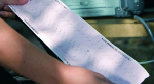 Kaliski szpital ma nową poradnię dla pacjentów z zaburzeniami rytmu