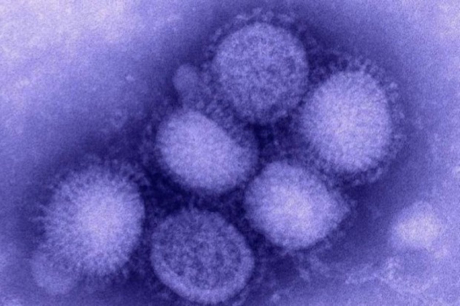 Wirus A/H1N1 Fot. Archiwum RZ Warszawa: od początku br. stwierdzono 18 przypadków zakażenia A/H1N1