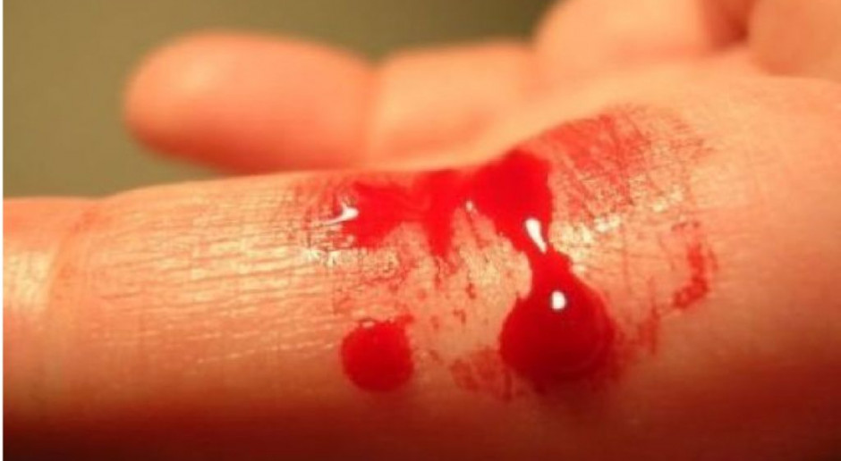 W Sejmie o hemofilii: pacjenci powinni mieć możliwość kompleksowego leczenia