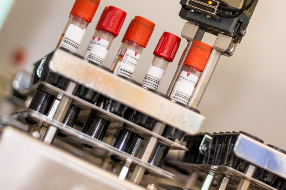 24,6 proc. laboratoriów szpitalnych zostało wykupionych przez zewnętrzne podmioty. Fot. PTWP Laboratoria diagnostyczne: co czwarte poza szpitalem