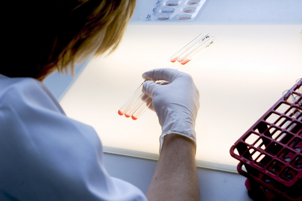 Laboratorium i szpital - razem czy osobno