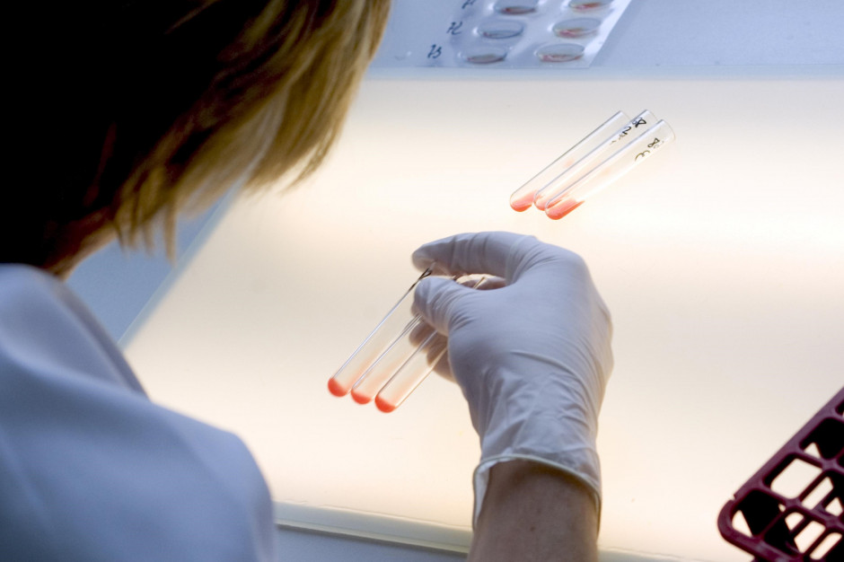 Diagności laboratoryjni czują się w pomijani w przyznawaniu podwyżek; FOT. PTWP (zdjęcie ilustracyjne) Kolejne zawody medyczne domagają się podwyżek. Nie chcą już spokojnie czekać