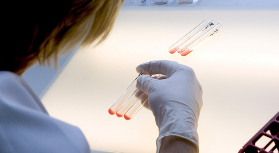 Mamy polski tani test wykrywający 70 genów odpowiedzialnych za nowotwory?