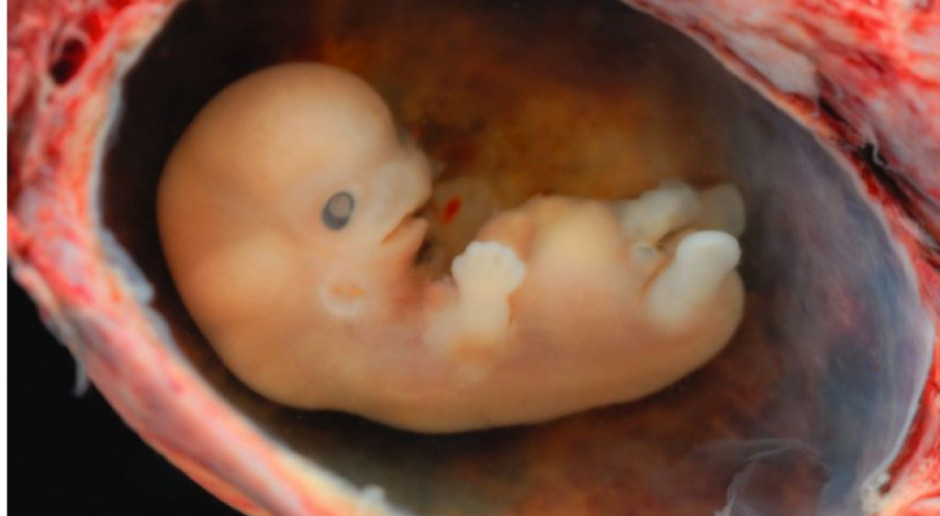 Portugalia: zamrożone embriony mogą być niszczone