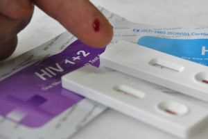 Łódź: bezpłatne testy na HIV dla 400 osób