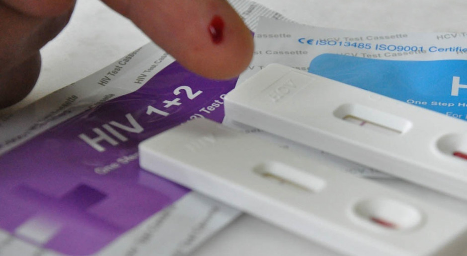 Eksperci: Polacy zbyt rzadko wykonują testy na obecność wirusa HIV