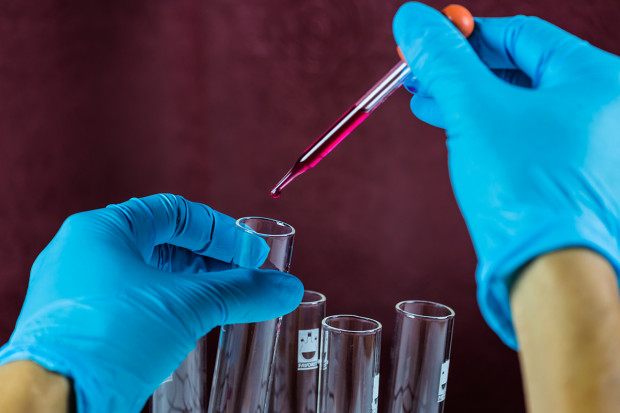 Kto szkodzi diagnostyce laboratoryjnej?