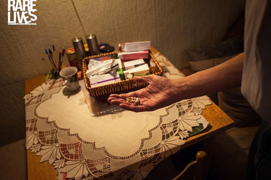 Fot. Aldo Soligno, Rare Lives Raport: niewidoczni pacjenci z chorobą Fabry’ego