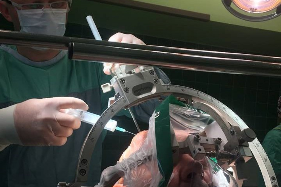 Operacja trwała sześć godzin i zakończyła się pełnym sukcesem. Już w trakcie zabiegu obserwowano ustępowanie objawów choroby - mówi neurochirurg dr Dariusz Łątka. Fot. Materiały prasowe Opole: neurochirurdzy z WCM wszczepili stymulator DBS