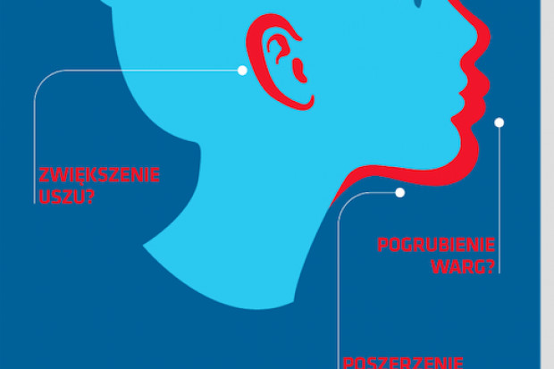 Akromegalia występuje niezmiernie rzadko, z taką samą częstotliwością u kobiet, jak i u mężczyzn, chociaż akurat w Polsce, częściej wykrywana jest u kobiet. Fot. Materiały prasowe Akromegalię można skutecznie leczyć, liczy się czas i dostęp do terapii