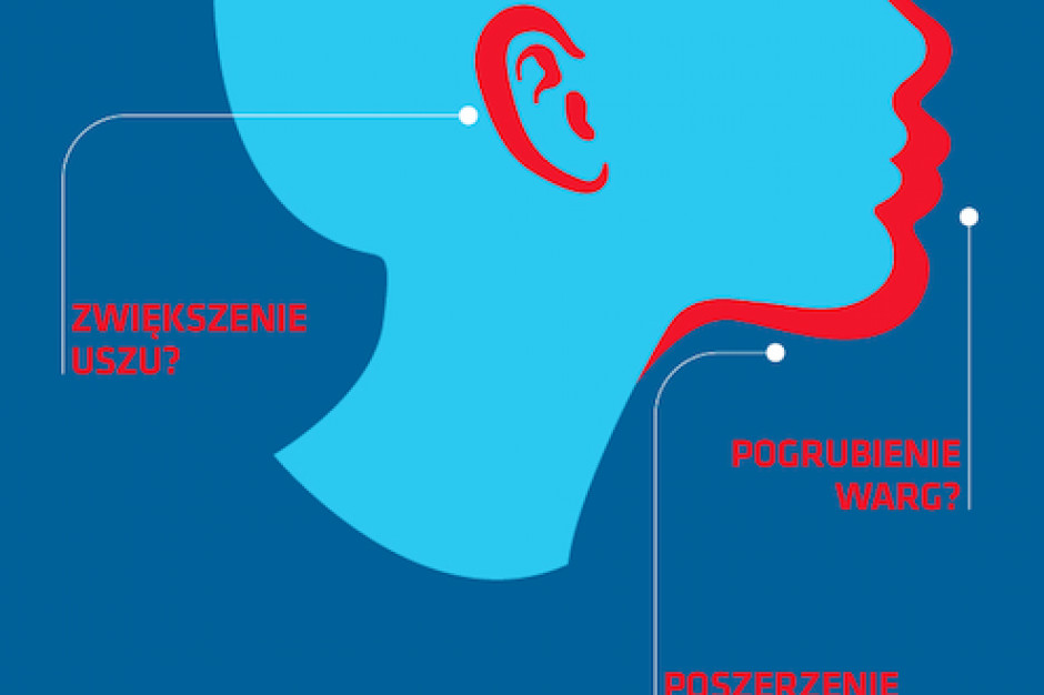 W miarę upływu lat u osób z akromegalią zaostrzają się rysy twarzy i rozrasta żuchwa. Fot. Archiwum Ogólnopolski Dzień Wiedzy o Akromegalii: rusza specjalna infolinia