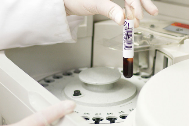 Błędy w diagnostyce laboratoryjnej? Ich źródłem bywa sam pacjent