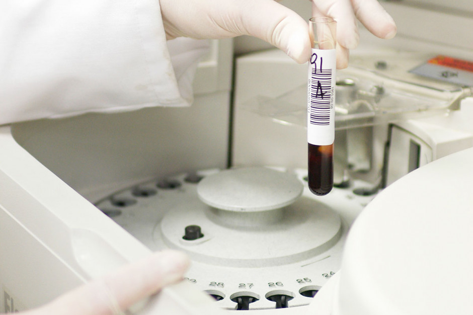 Błędy w diagnostyce laboratoryjnej? Ich źródłem bywa sam pacjent