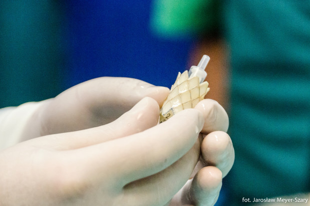 To był pierwszy zabieg przezskórnej implantacji zastawki tętnicy płucnej w Uniwersyteckim Centrum Klinicznym w Gdańsku. Fot. Materiały prasowe UCK Gdańsk: kardiochirurdzy z UCK uratowali serce wykorzystując druk 3D