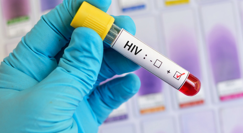Mazowieckie: jest raport nt. HIV i AIDS. LIczba zakażeń rośnie
