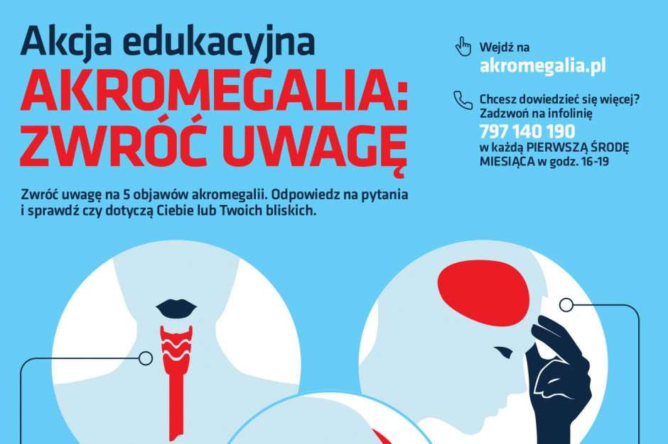 Nieleczona akromegalia skraca życie o około 10 lat, w kraju choruje na nią 2 tysiące osób