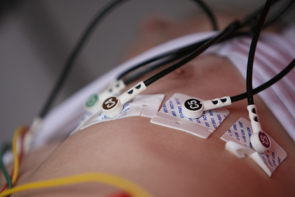 Kluczową częścią programu jest wykrycie czynników ryzyka chorób sercowo-naczyniowych wśród zdrowych dorosłych Polaków w wieku produkcyjnym oraz wdrożenie zmian w ich stylu życia. Fot. PTWP UCK w Gdańsku szuka partnerów w POZ do projektu profilaktyki miażdżycy tętnic i chorób serca