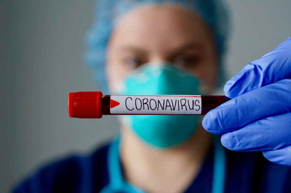 Testy na koronawirusa wciąż wzbudzją kontrowersje; FOT. Shutterstock Cieszyński: zasady wykonywania testów na koronawirusa są jednakowe dla wszystkich