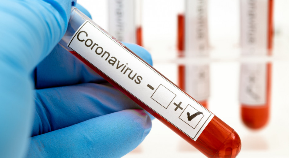 Błędny wynik testu na obecność koronawirusa skierował personel medyczny na kwarantannę