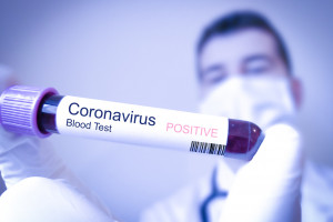 Senacka komisja zdrowia proponuje: dla medyków badania wykrywające koronawirusa - raz w tygodniu