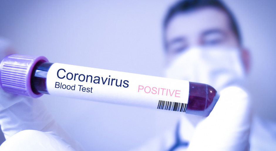 ZEA: 1007 nowych przypadków koronawirusa, najwięcej od początku epidemii