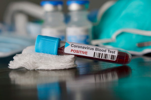Testy na koronawirusa: znamy dane z województw, są duże dysproporcje