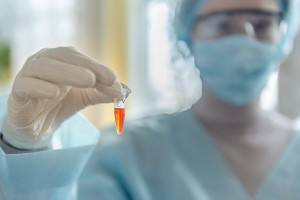 MZ: testy na obecność koronawirusa wykonuje 58 laboratoriów
