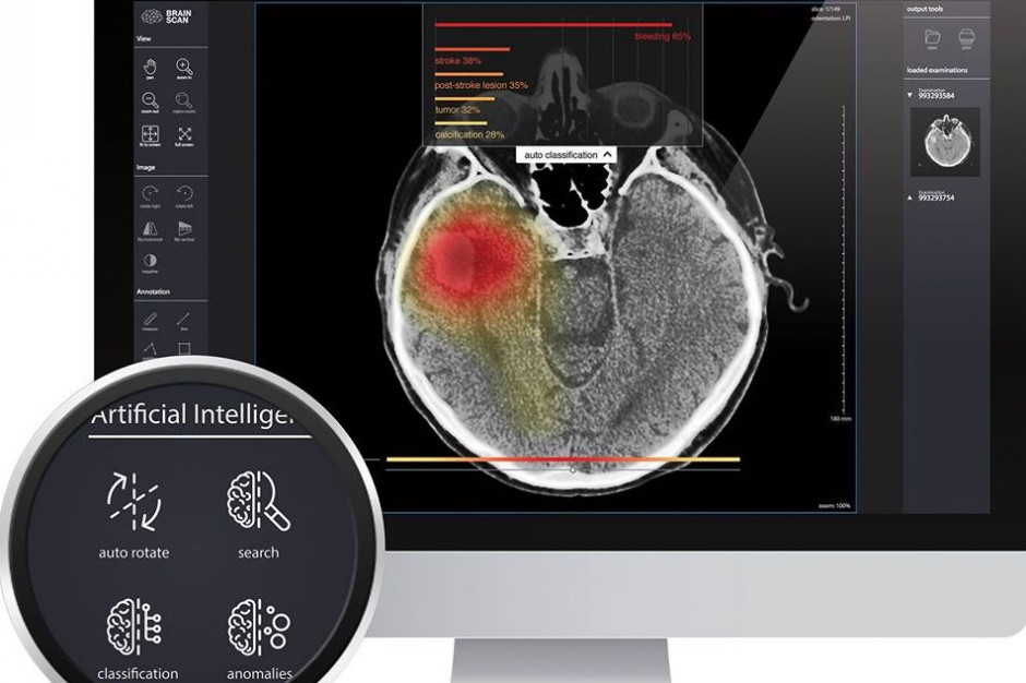Rynek medyczntych startupów rozwija się dynamicznie; FOT. Brainscan/Materiały prasowe Startupy medyczne w Polsce. Zdobywają rynek, pomagają pacjentom