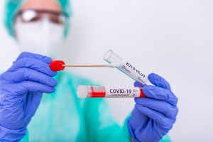 Dzienny raport o koronawirusie: dziś 5,7 tys. zakażeń, ale zgonów aż 460