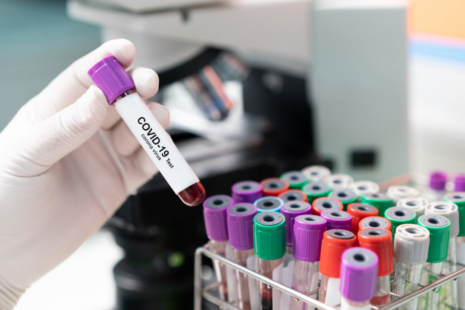 FOT. Shutterstock (zdjęcie ilustracyjne) Słowacja: rekordowa liczba nowych zakażeń potwierdzonych testami PCR