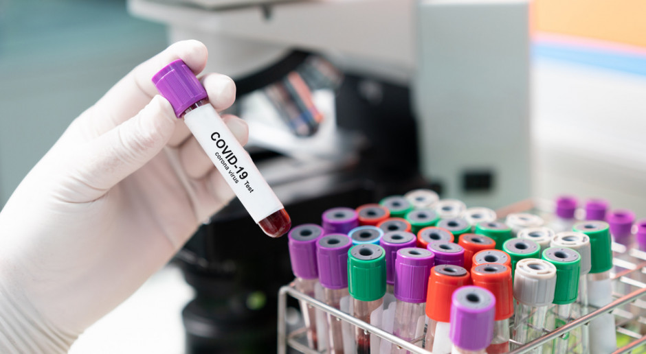 MZ: 241 laboratoriów diagnostycznych w kraju wykonuje testy na koronawirusa