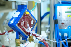 Opole: zdrowieje ponad połowa pacjentów podłączanych do ECMO