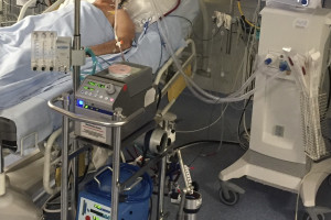 W Covid-19 ECMO jest dla niektórych pacjentów ostatnią szansą ratunku