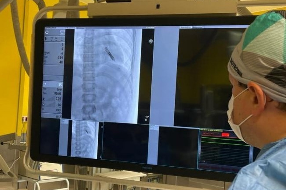 Rejestrator pozwoli na zdalne monitorowanie stanu zdrowia operowanego nastolatka. Fot. Warszawski Uniwersytet Medyczny Lekarze z USK WUM wszczepili dziecku narzędzie wykrywające arytmię