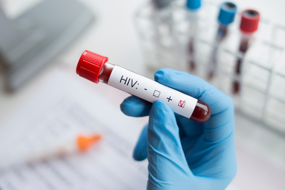 Szczepionka na HIV pomogłaby wielu chorym. Fot. Shutterstock O HIV wiemy coraz więcej, ale wciąż czekamy na szczepionkę. Moderna rozpoczęła badania