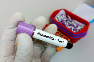 Hemofilia. Chorzy kończą 18 lat i wypadają poza system. Eksperci apelują o zmiany i kontynuację spersonalizowanej profilaktyki