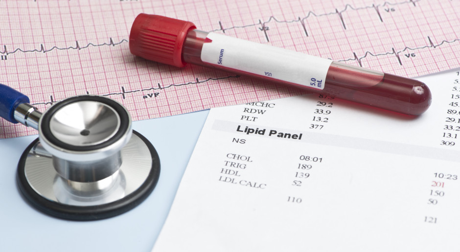 Novartis informuje o programie leczenia inclisiranem pacjentów z podwyższonym cholesterolem