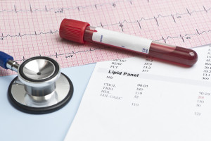 Hipercholesterolemia u pacjentów kardiologicznych będzie leczona skuteczniej. Co można zrobić lepiej?